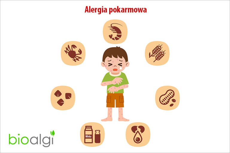 Alergia pokarmowa