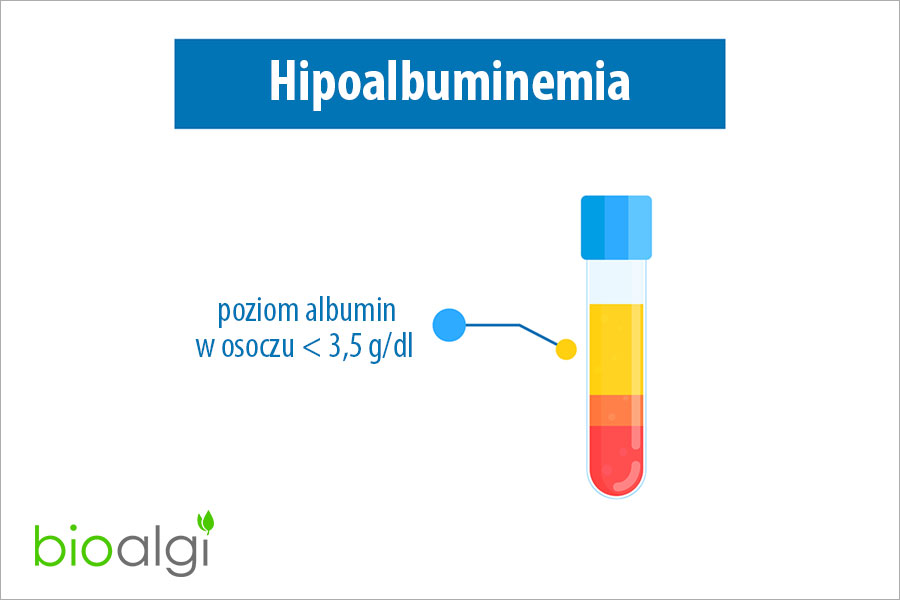Hipoalbuminemia