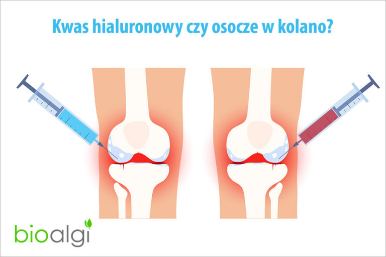 Kwas hialuronowy czy osocze w kolano?