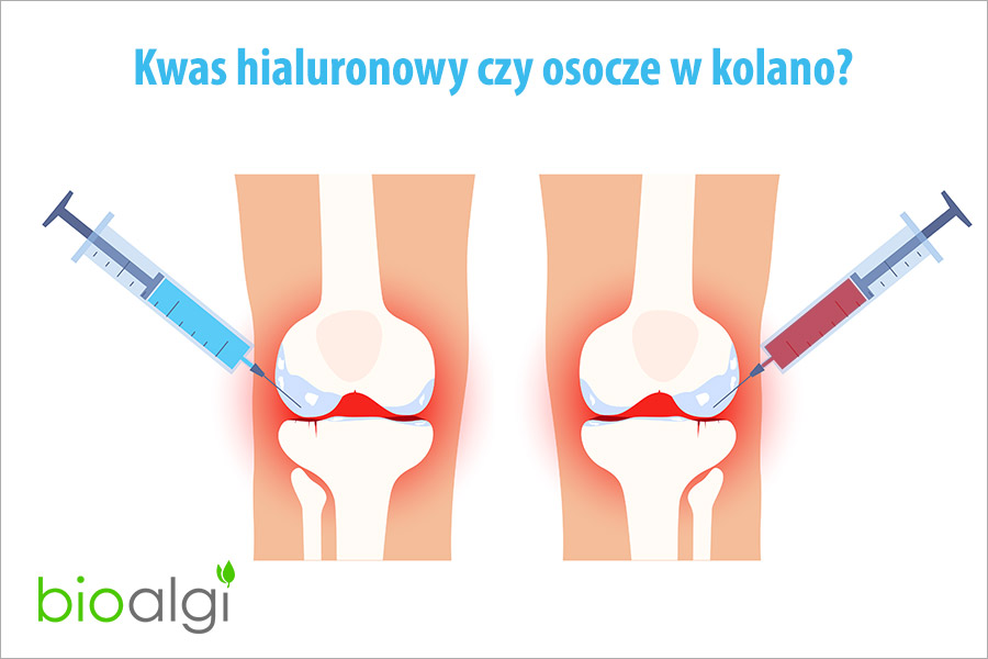 Kwas hialuronowy czy osocze w kolano?